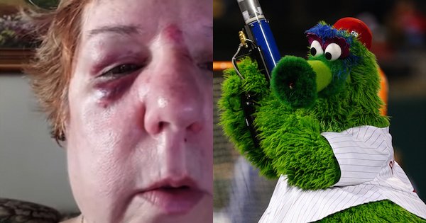 Phillies fan injured after Phillie Phanatic's flying hot dog hit