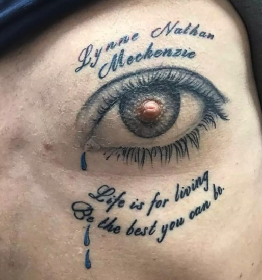 Is your Ye tattoo no longer hip Free removal offered  The Mercury News